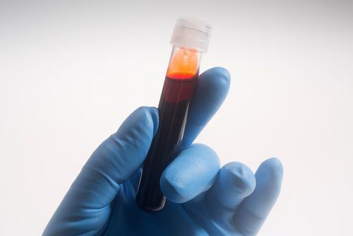 Blood test following DUI arrest by a repeat drunk driver.