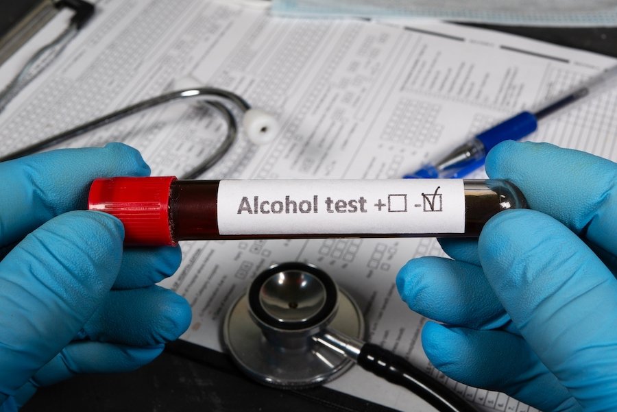 Gloved hands holding a vial of blood labeled "alcohol test" in a lab