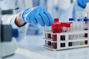 Laboratory worker's gloved hands handling vials of blood following a DUI blood draw